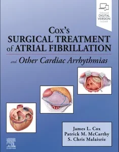 Cox’s Surgical Treatment of Atrial Fibrillation