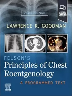 Felson's Principles of Chest Roentgenology