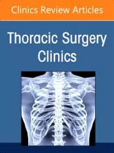 Pulmonary Metastasectomy, An Issue of Thoracic Surgery Clinics of North America