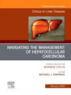 Navigating the Management of Hepatocellular Carcinoma, An Issue of Clinics in Liver Disease