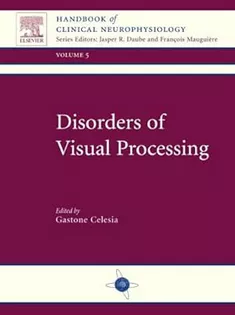 Disorders of Visual Processing: Handbook of Clinical Neurophysiology Series