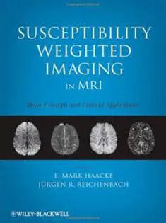 Susceptibility Weighted Imaging in MRI