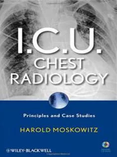I.C.U. Chest Radiology: Principles & Case Studies