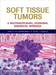 Soft Tissue Tumors: A Multidisciplinary, Decisional Diagnostic Approach