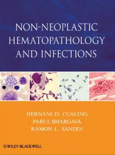 Non-Neoplastic Hematopathology and Infections