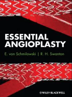 Essential Angioplasty