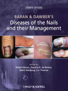 Baran and Dawber's Diseases of the Nails and Their Management