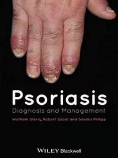9780470657362 Psoriasis: Diagnosis and Management