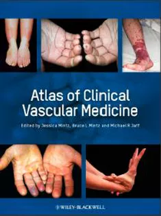 Atlas of Clinical Vascular Medicine