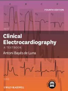 Clinical Electrocardiography: A Textbook 1