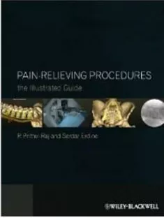 Pain-Relieving Procedures: The Illustrated Guide