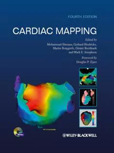 Cardiac Mapping