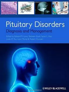 Pituitary Disorders: Diagnosis and Management