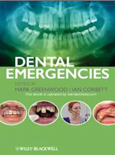Dental Emergencies