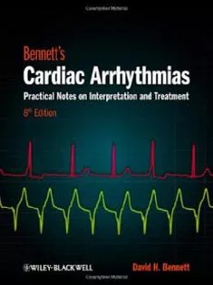 Bennett's Cardiac Arrhythmias Practical Notes on Interpretation & Treatment