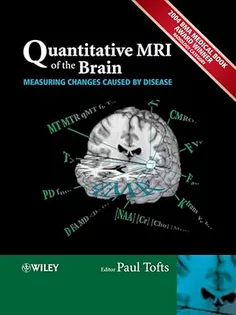Quantitative MRI of the Brain: Measuring Changes Caused by Disease