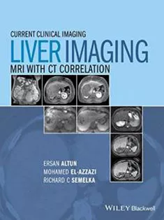 9780470906255 Liver Imaging: MRI with CT Correlation