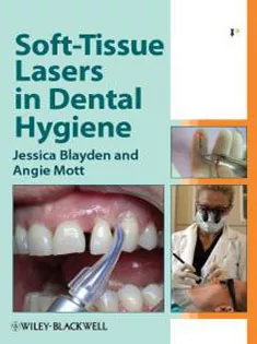 Soft-Tissue Lasers in Dental Hygiene