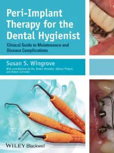 Peri-Implant Therapy for the Dental Hygienist 1