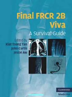 Final FRCR 2B Viva: A Survival Guide