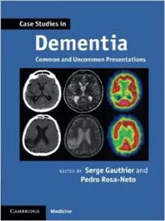 Case Studies in Dementia: Common and Uncommon Presentations