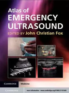 Atlas of Emergency Ultrasound