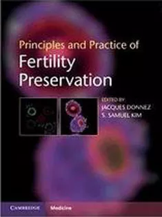 Principles and Practice of Fertility Preservation