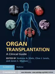 Organ Transplantation: A Clinical Guide