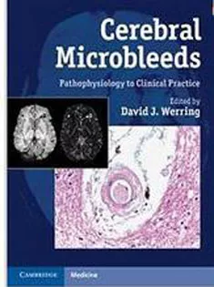 Cerebral Microbleeds: Pathophysiology to Clinical Practice