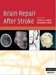 Brain Repair After Stroke