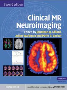 Clinical MR Neuroimaging: Physiological and Functional Techniques