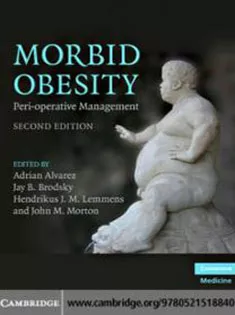 Morbid Obesity: Peri-operative Management