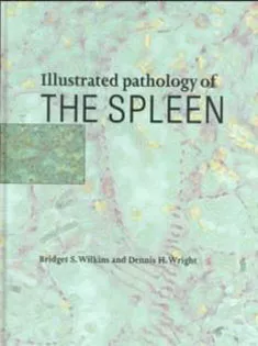 Illustrated Pathology of the Spleen