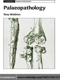 (Palaeopathology (Cambridge Manuals in Archaeology