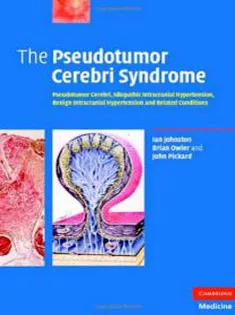 The Pseudotumor Cerebri Syndrome