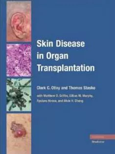 Skin Disease in Organ Transplantation