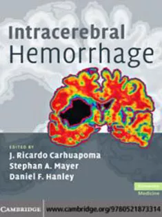 Intracerebral Hemorrhage