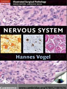 Nervous System