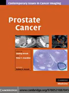 Prostate Cancer-Contemporary Issues in Cancer Imaging