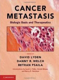 Cancer Metastasis