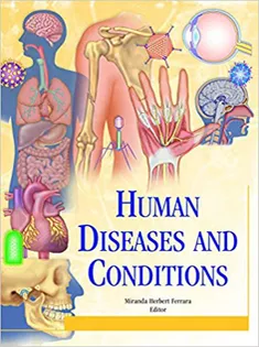 Human Diseases and Conditions: 4 Volume Set