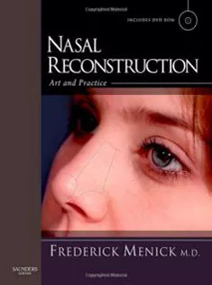 Nasal Reconstruction Art & Practice