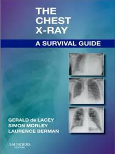 The Chest X-Ray: A Survival Guide