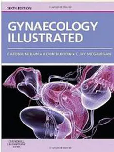 Gynaecology Illustrated