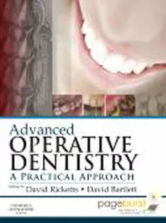 Advanced Operative Dentistry