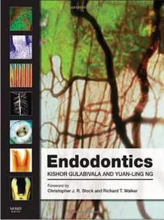 Endodontics