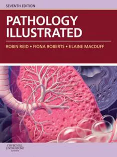 Pathology Illustrated