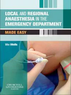 Local & Regional Anaesthesia in the Emergency Department Made Easy
