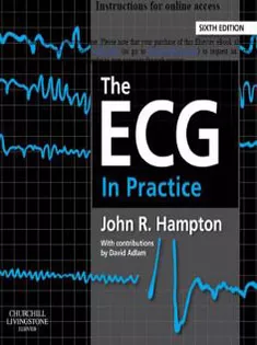 The ECG In Practice
