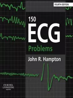 150 ECG Problems